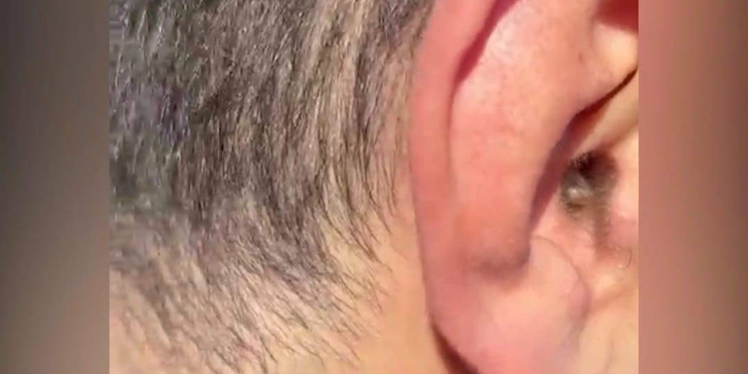 Kulaklarının içine uyuşturucu saklayan şüpheli yakalandı